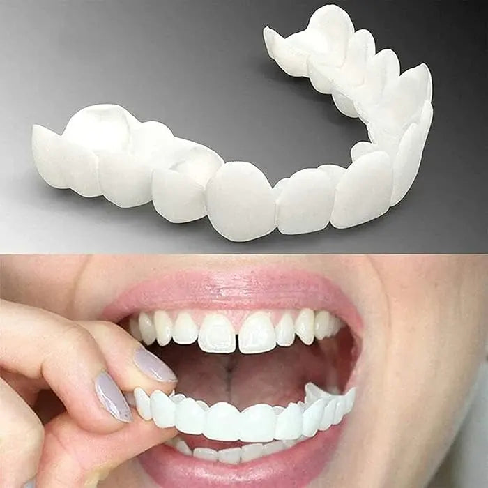 SmileFix Dental Veneers | Prachtig witte tanden in slechts 60 seconden!