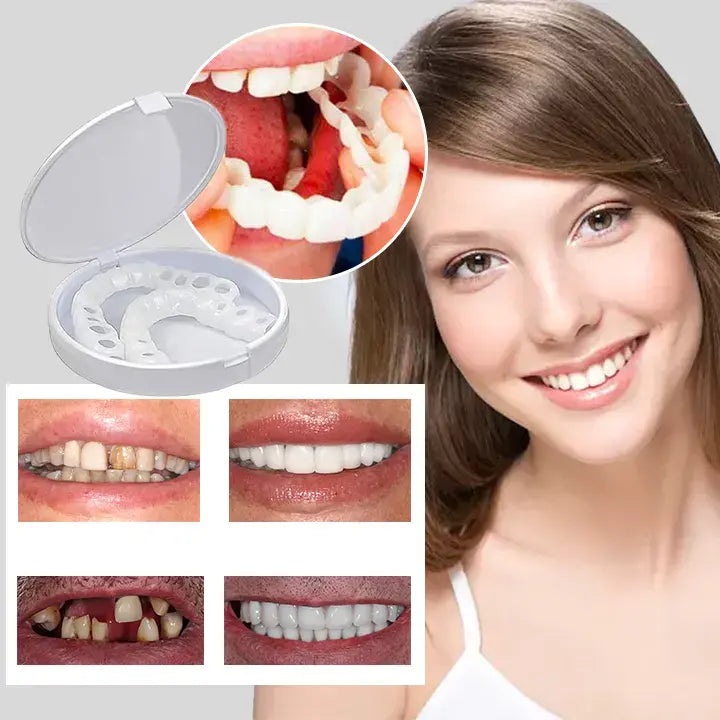 SmileFix Dental Veneers | Prachtig witte tanden in slechts 60 seconden!