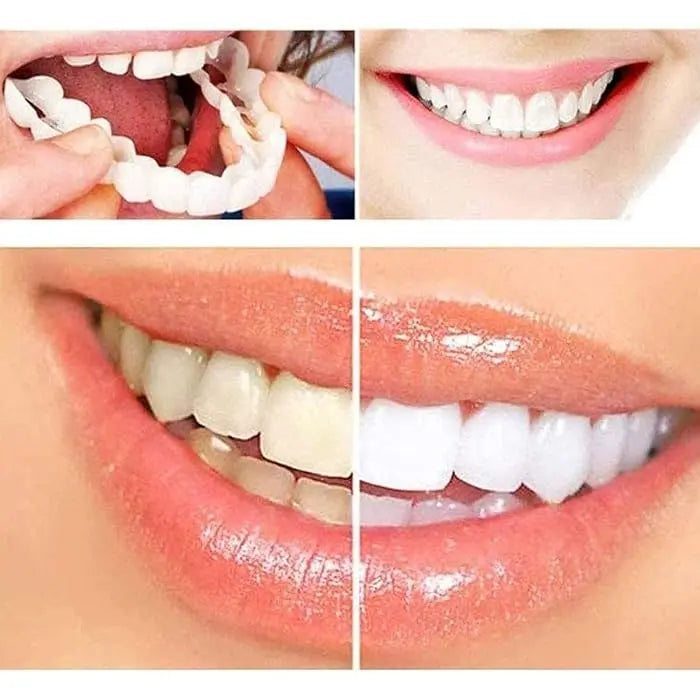 SmileFix Dental Veneers | Prachtig witte tanden in slechts 60 seconden!