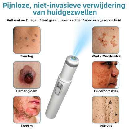 Xorita™ Niet-invasieve Laser pen voor Moedervlek - en Wratverwi jdering Promax