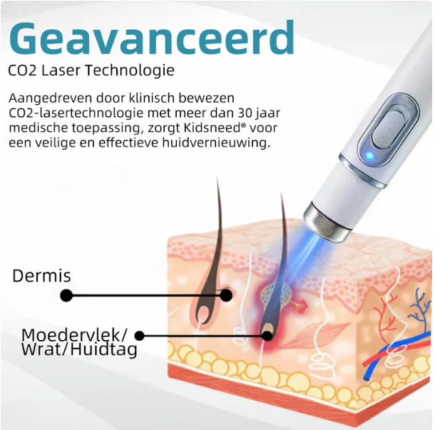 Xorita™ Niet-invasieve Laser pen voor Moedervlek - en Wratverwi jdering Promax