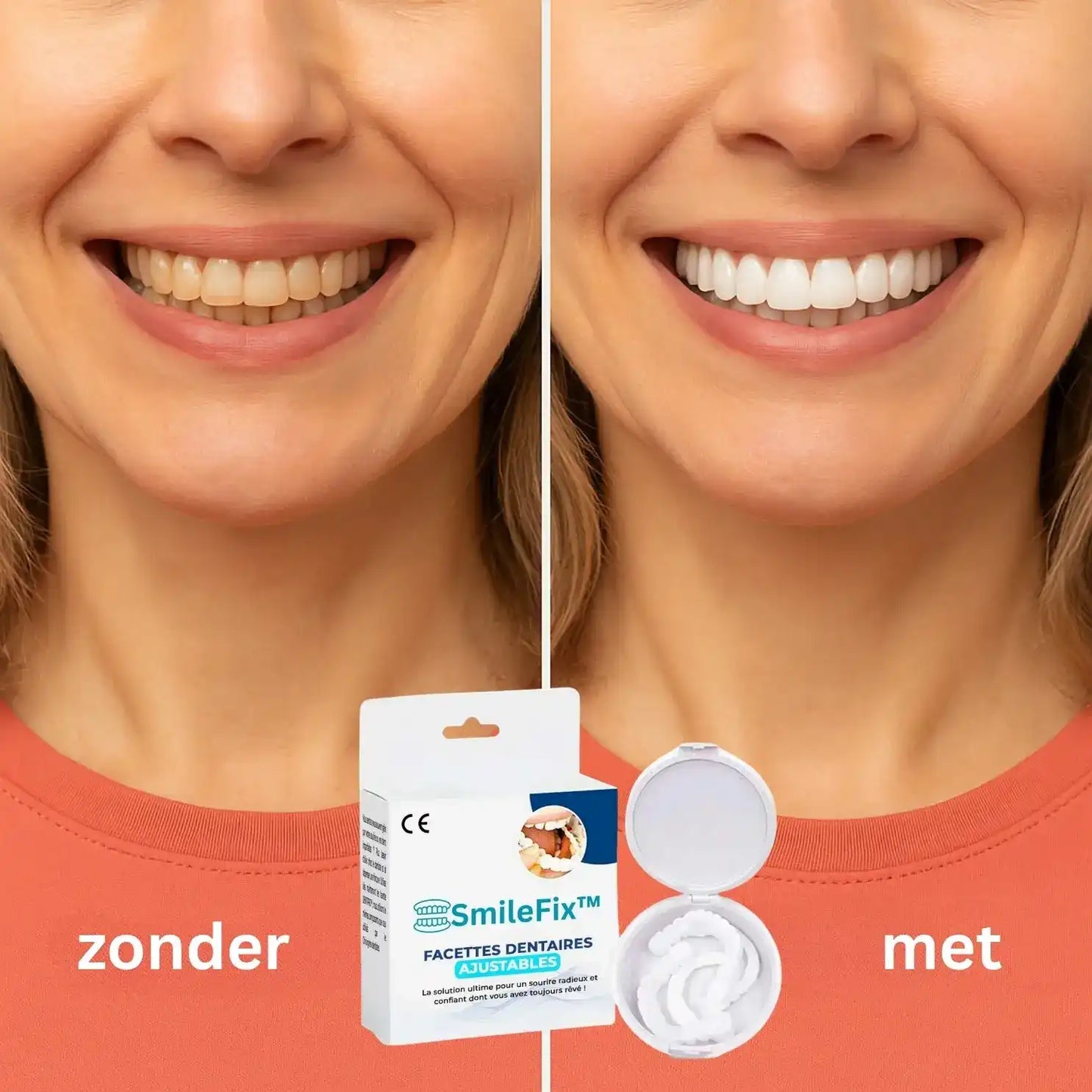 SmileFix Dental Veneers | Prachtig witte tanden in slechts 60 seconden!