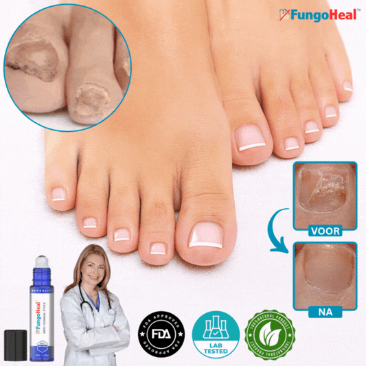 FungoHeal™ | Verwijder Nagelschimmel en Herstelt Gezonde Nagels Met 95% Binnen 7 Dagen