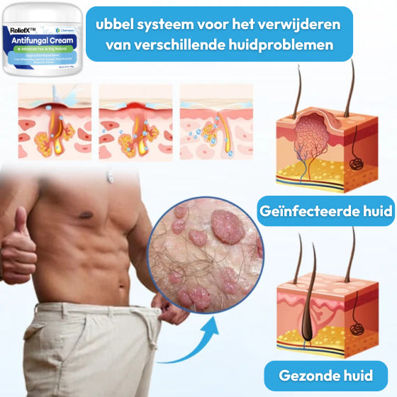 ReliefX™ Anti-eczeemcrème | Verlicht jeukende eczeem permanent in slechts 5 minuten!