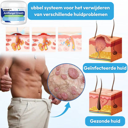 ReliefX™ Anti-eczeemcrème | Verlicht jeukende eczeem permanent in slechts 5 minuten!