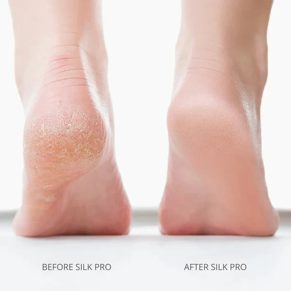 Lovi Silk Pro 2